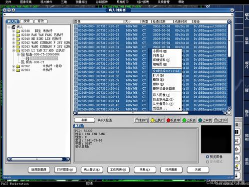 醫(yī)學(xué)影像信息系統(tǒng)(PACS)源碼基礎(chǔ)解析 架構(gòu)、原理與數(shù)據(jù)處理服務(wù)